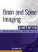 Brain and Spine Imaging Patterns: Brain & Spine Imaging by Chi-Shing Zee