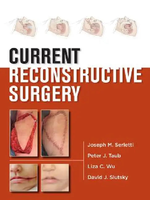 Current Reconstructive Surgery by Joseph M. Serletti, Peter J. Taub, Liza Wu