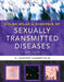 Color Atlas & Synopsis Of Sexually Transmitted Diseases by Handsfield