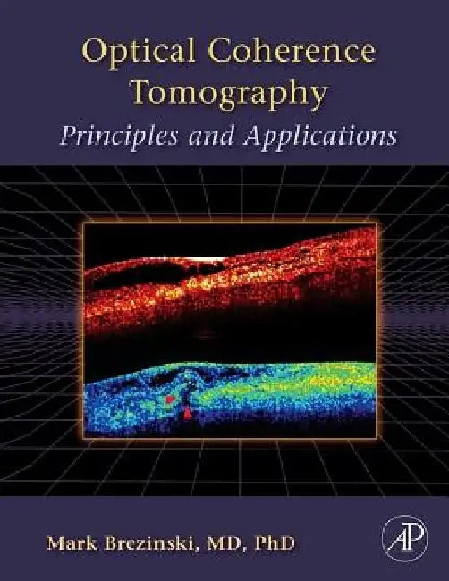Optical Coherence Tomography: Principles and Applications by Mark E. Brezinski