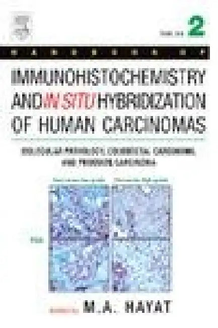 Handbook of Immunohistochemistry and in Situ Hybridization of Human Carcinomas: Molecular Pathology, Colorectal Carcinoma, and Prostate Carcinoma by M. A. Hayat