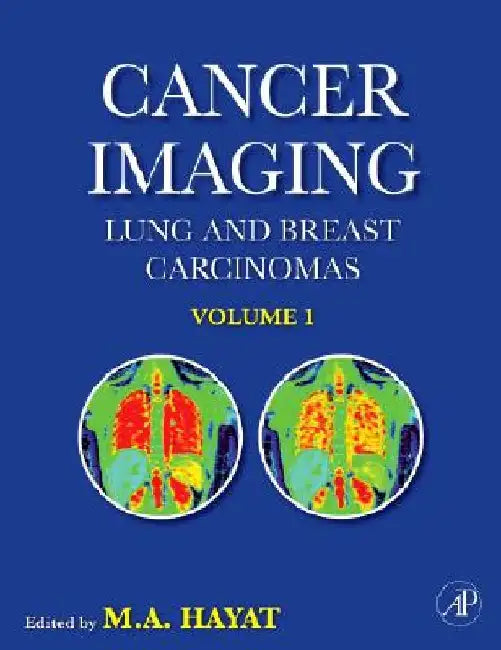 Cancer Imaging: Lung and Breast Carcinomas by M. A. Hayat