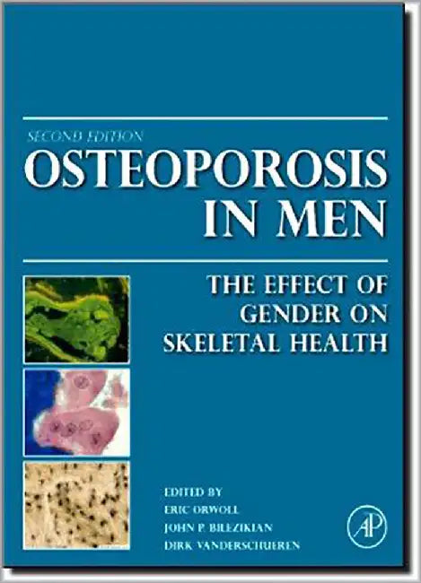 Osteoporosis In Men: The Effects of Gender on Skeletal Health by Eric Orwoll, Eric S. Orwoll, John P. Bilezikian