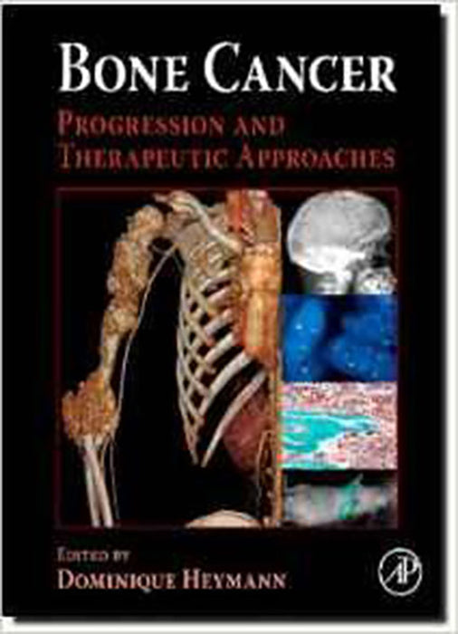 Bone Cancer: Progression and Therapeutic Approaches