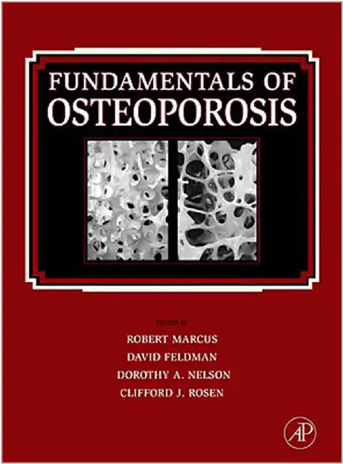 Fundamentals Of Osteoporosis by Robert Marcus