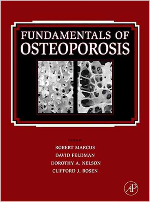 Fundamentals Of Osteoporosis