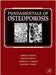 Fundamentals Of Osteoporosis by Robert Marcus