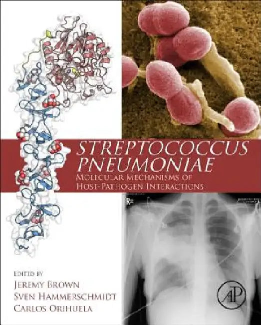 Streptococcus Pneumoniae: Molecular Mechanisms of Host-Pathogen Interactions by Jeremy Brown
