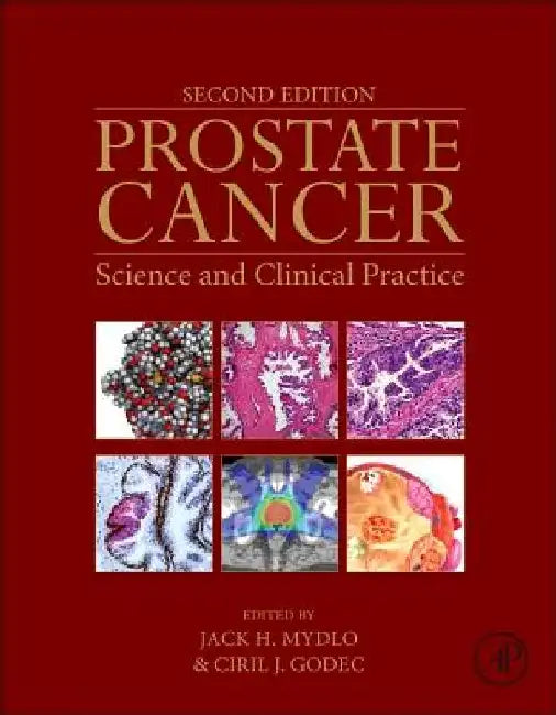 Prostate Cancer: Science and Clinical Practice by Jack H. Mydlo