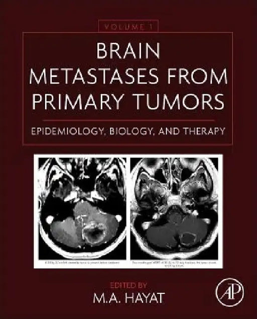 Brain Metastases from Primary Tumors Epidemiology, Biology, and Therapy by M. A. Hayat