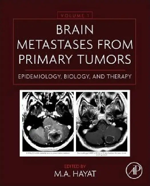 Brain Metastases from Primary Tumors Epidemiology, Biology, and Therapy by M. A. Hayat