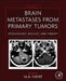 Brain Metastases from Primary Tumors Epidemiology, Biology, and Therapy by M. A. Hayat
