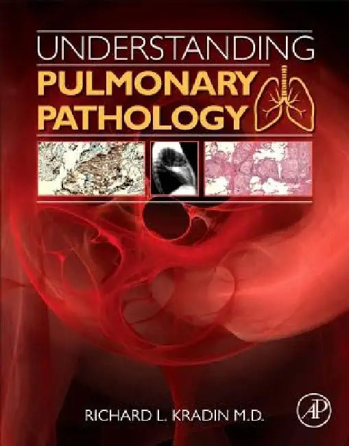 Understanding Pulmonary Pathology: Applying Pathological Findings in Therapeutic Decision Making by Richard L. Kradin