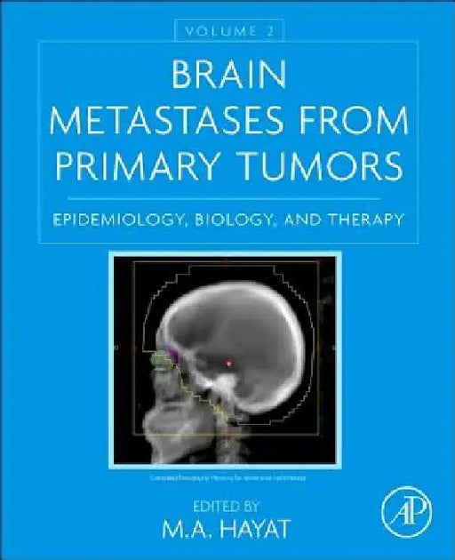 Brain Metastases from Primary Tumors, Epidemiology, Biology, and Therapy by M. A. Hayat