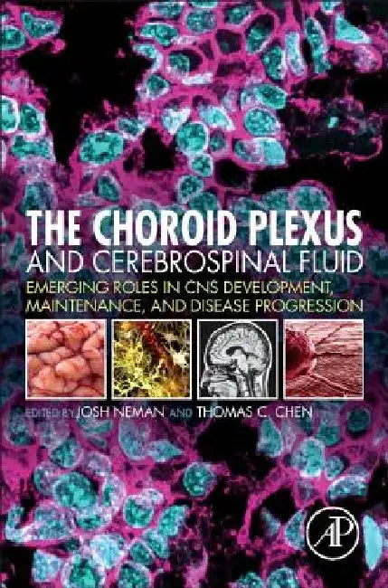 The Choroid Plexus and Cerebrospinal Fluid: Emerging Roles in CNS Development, Maintenance, and Disease Progression by Josh Neman