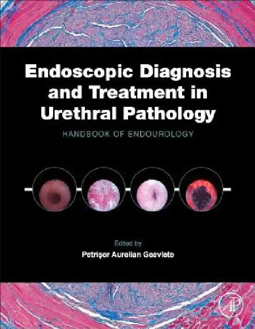 Endoscopic Diagnosis and Treatment in Urethral Pathology: Handbook of Endourology by Petrisor Aurelian Geavlete