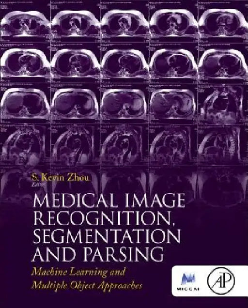 Medical Image Recognition, Segmentation and Parsing: Machine Learning and Multiple Object Approaches by S. Kevin Zhou
