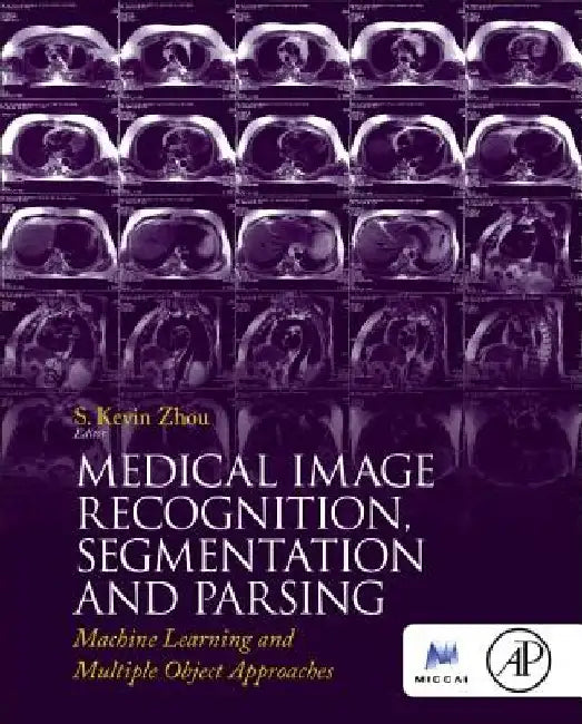 Medical Image Recognition, Segmentation and Parsing: Machine Learning and Multiple Object Approaches by S. Kevin Zhou