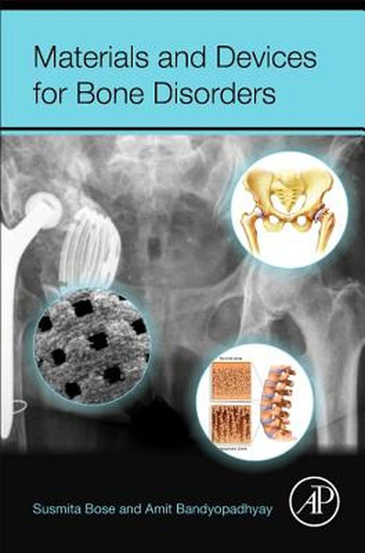 Materials and Devices for Bone Disorders by Amit Bandyopadhyay