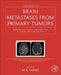 Brain Metastases from Primary Tumors, Epidemiology, Biology, and Therapy of Melanoma and Other Cancers by M. A. Hayat