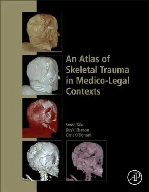 An Atlas of Skeletal Trauma in Medico-Legal Contexts by Soren Blau