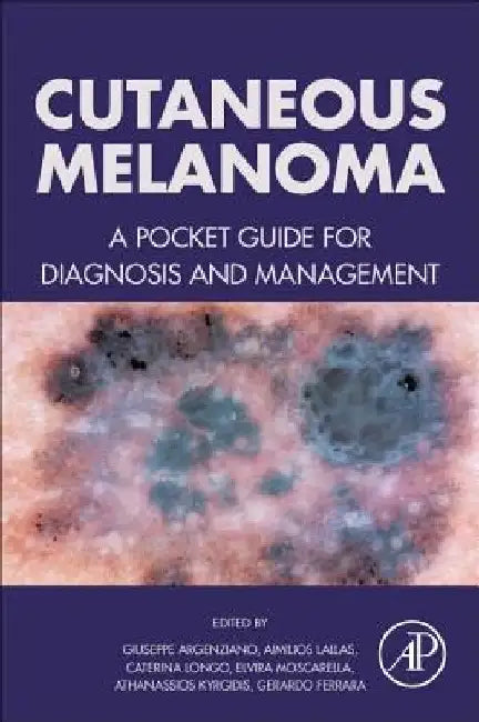 Cutaneous Melanoma: A Pocket Guide for Diagnosis and Management by Giuseppe Argenziano