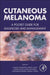 Cutaneous Melanoma: A Pocket Guide for Diagnosis and Management by Giuseppe Argenziano