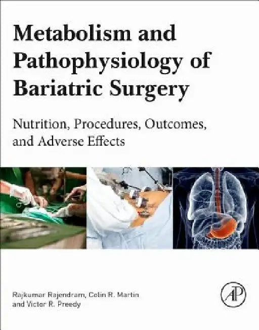 Metabolism and Pathophysiology of Bariatric Surgery: Nutrition, Procedures, Outcomes and Adverse Effects by Victor R. Preedy