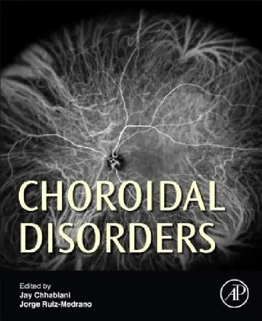 Choroidal Disorders by Jay Chhablani