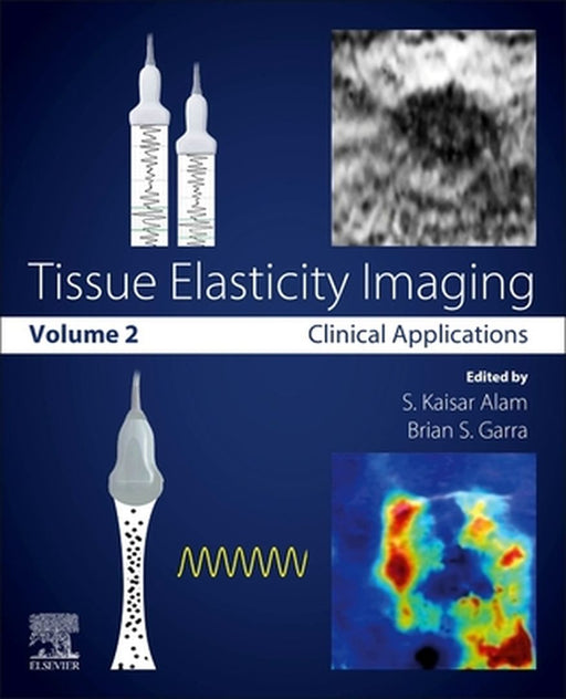 Tissue Elasticity Imaging: Volume 2: Clinical Applications 1ed by Alam S. Kaisar