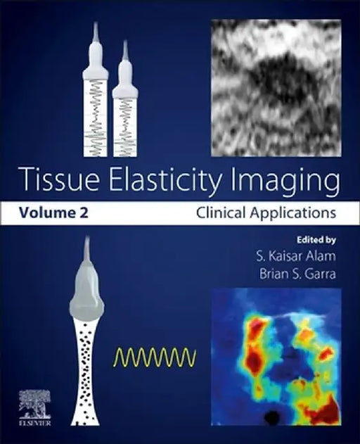 Tissue Elasticity Imaging: Volume 2: Clinical Applications 1ed by Alam S. Kaisar