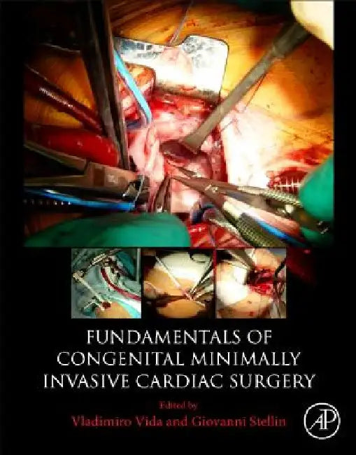 Fundamentals of Congenital Minimally Invasive Cardiac Surgery by Vladimiro Vida