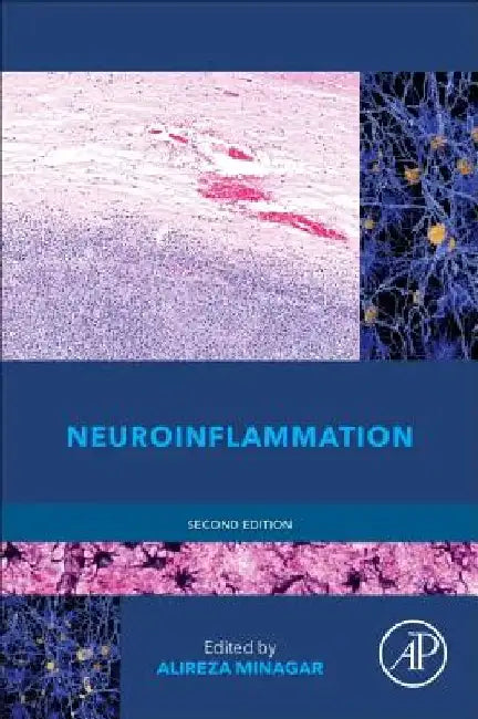 Neuroinflammation by Alireza Minagar