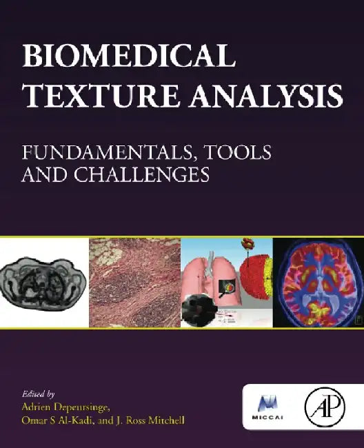 Biomedical Texture Analysis: Fundamentals, Tools and Challenges by Depeursinge, S Al-Kadi , Mitchell