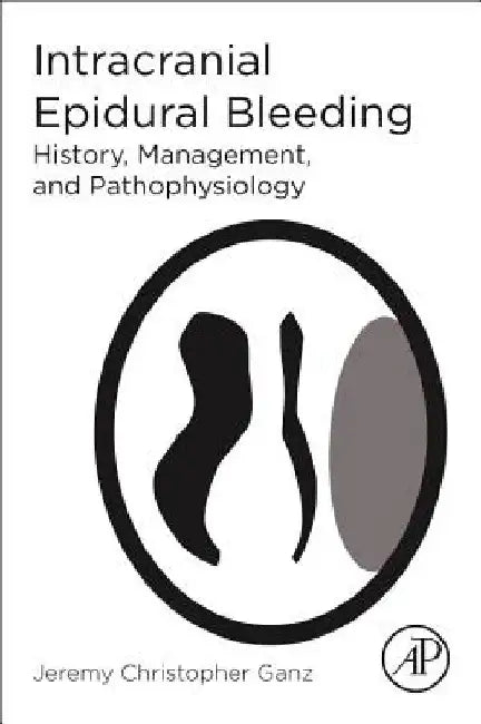 Intracranial Epidural Bleeding: History, Management, and Pathophysiology by Jeremy Christopher Ganz