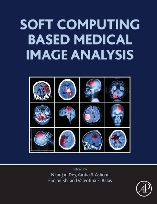 Soft Computing Based Medical Image Analysis: 1ed: by Dey Nilanjan