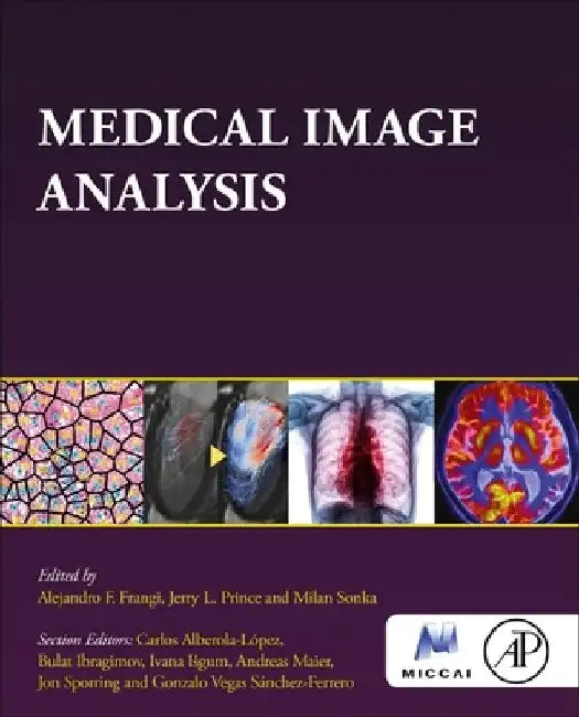 Medical Image Analysis by Alejandro Frangi