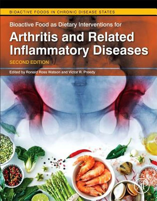 Bioactive Food as Dietary Interventions for Arthritis and Related: Inflammatory Diseases by Watson Ronald