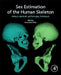 Sex Estimation of the Human Skeleton: History, Methods, and Emerging Techniques by Alexandra R. Klales