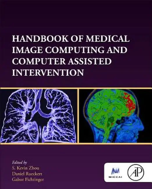 Handbook of Medical Image Computing and Computer Assisted Intervention by Zhou S. Kevin
