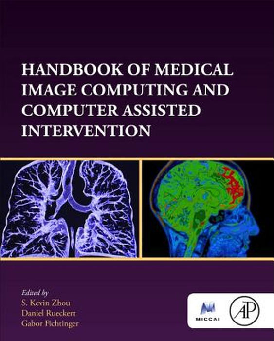 Handbook of Medical Image Computing and Computer Assisted Intervention by Zhou S. Kevin