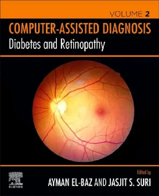 Diabetes and Retinopathy by Ayman S. El-Baz