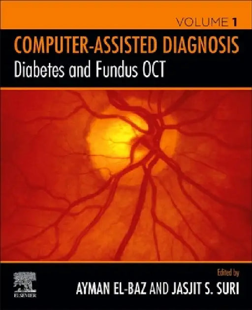 Diabetes and Fundus OCT by Ayman S. El-Baz