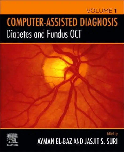 Diabetes and Fundus OCT by Ayman S. El-Baz