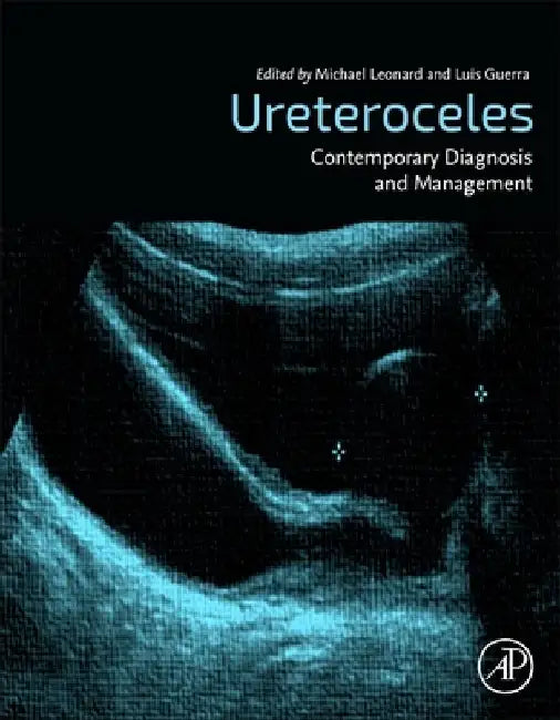 Ureteroceles: Contemporary Diagnosis and Management by Michael P. Leonard