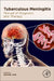 Tuberculous Meningitis: Manual of Diagnosis and Therapy by Jerome Chin