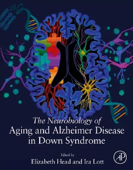 The Neurobiology of Aging and Alzheimer Disease in Down Syndrome by Elizabeth Head