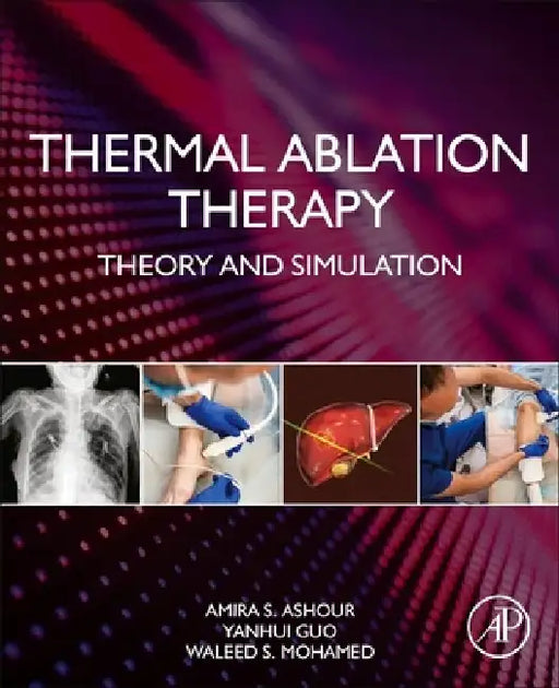 Thermal Ablation Therapy: Theory and Simulation by Amira S. Ashour