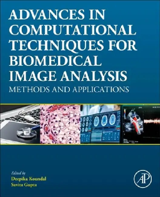 Advances in Computational Techniques for Biomedical Image Analysis: Methods and Applications by Deepika Koundal