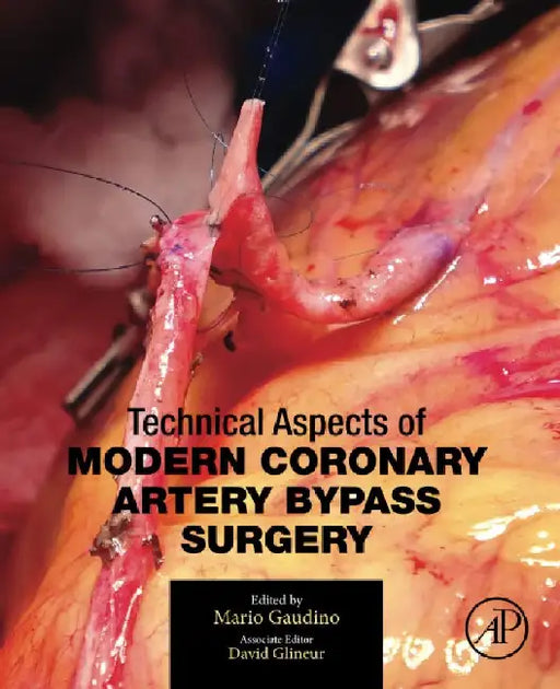 Technical Aspects of Modern Coronary Artery Bypass Surgery by Mario Gaudino